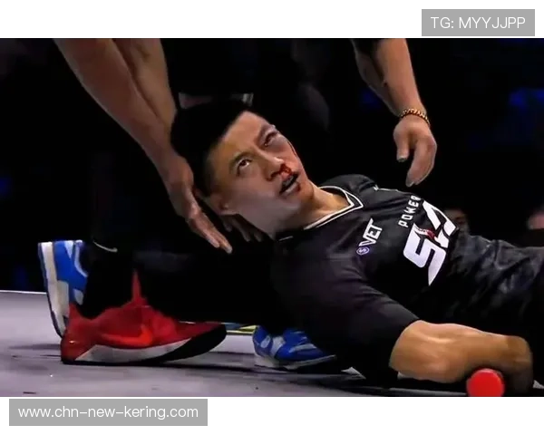 UFC重击断鼻,血腥画面背后的勇气与荣耀 UFC重击断鼻,血腥画面背后的勇气与荣耀